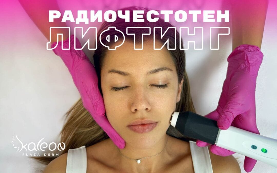 Радиочестотен лифтинг