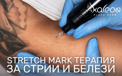 заличаване на стрии и белези stretch marks treatment