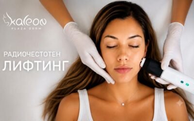 Радиочестотен лифтинг